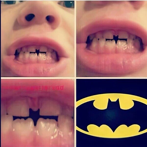 Meme_otros - Cuando el ortodoncista es fan de DC