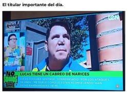 Enlace a Me da en la nariz que lo hicieron a propósito
