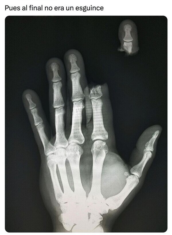Meme_otros - Más grave de lo que parecía...