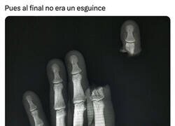 Enlace a Más grave de lo que parecía...