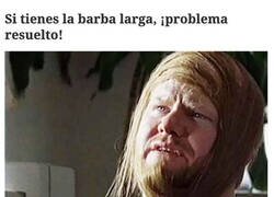 Enlace a Disimulando la calvície con la barba