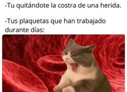 Enlace a Si las plaquetas pudieran darte una paliza lo harían