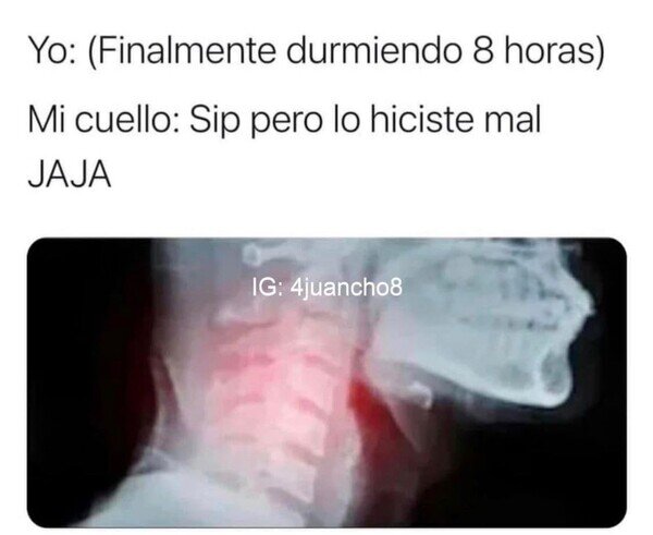 Meme_otros - Si no es un problema, es otro