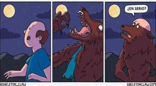 Otros - Ni siendo Hombre Lobo te libra de la calvície