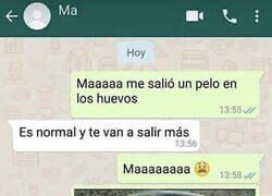 Enlace a Un pelo en los huevos