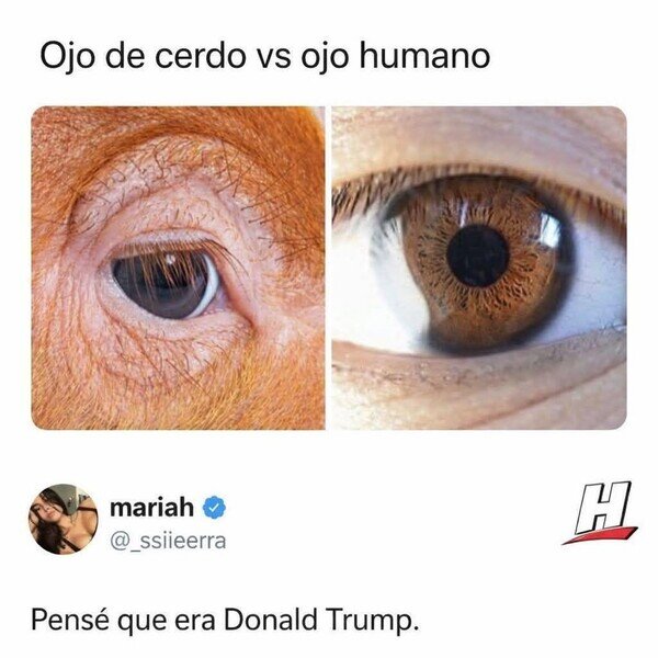 Otros - ¿A qué ojo se acerca más?