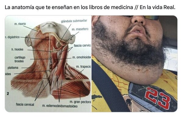 Otros - Cualquier parecido es pura coincidencia