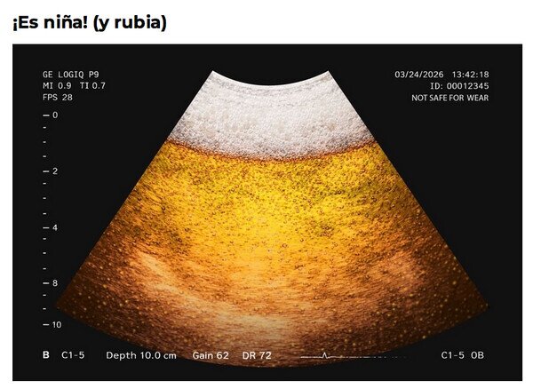 Otros - No estoy embarazado, es barriga cervecera