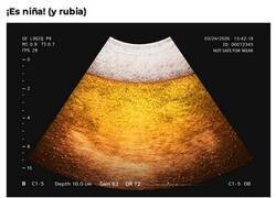 Enlace a No estoy embarazado, es barriga cervecera