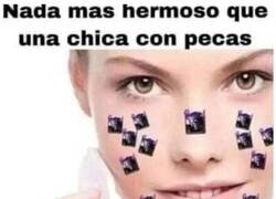 Enlace a Una chica con pecas