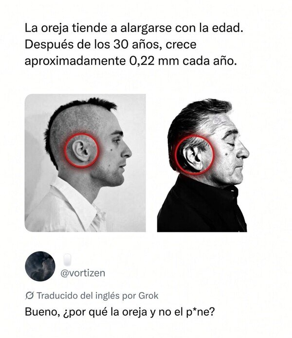oreja,edad,crecer
