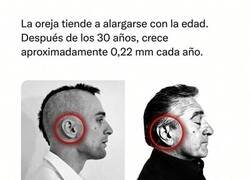 Enlace a El cuerpo humano es caprichoso