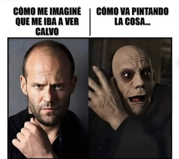 Otros - No voy a ser el típico calvo atractivo