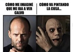 Enlace a No voy a ser el típico calvo atractivo
