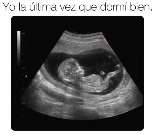 dormir,bien,feto,nacer