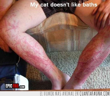 gato,araña,baño,limpia,pierna,herida,sangre,duele de solo mirar