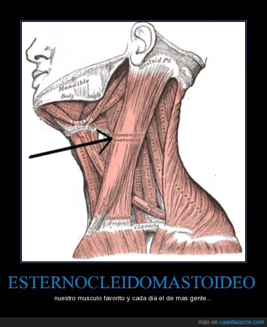 músculo,esternocleidomastoideo,cuello