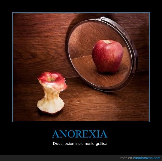 manzana,anorexia