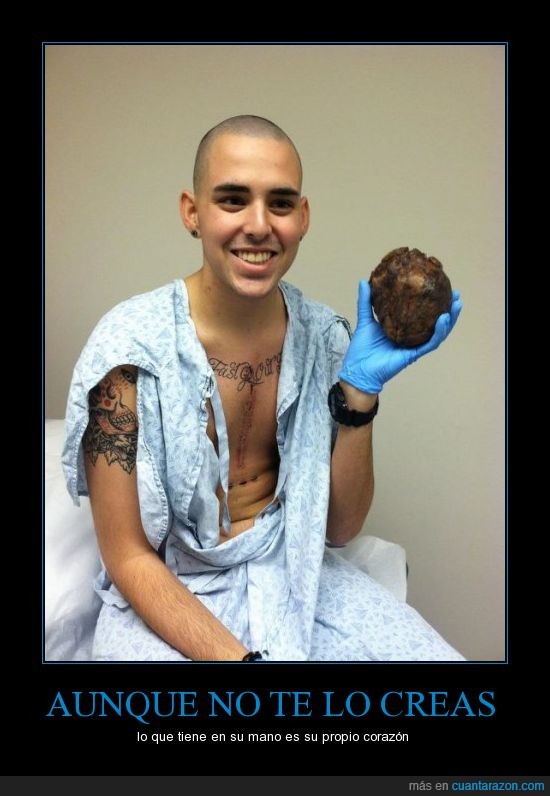 chico,corazón,joven,mano,operación,planeta curioso,tatuaje,transplante