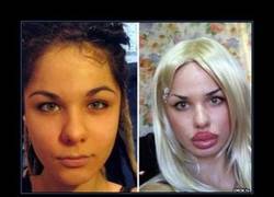 Enlace a CIRUGÍA PLÁSTICA