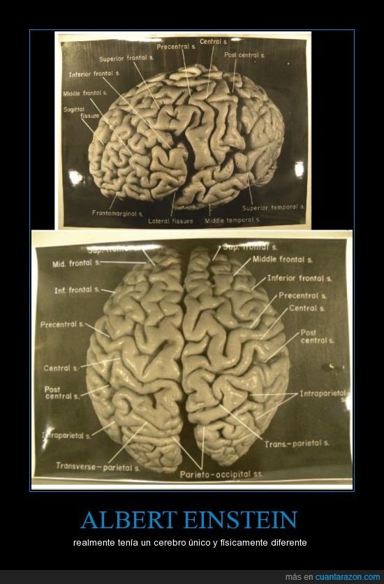 cerebro único,diferente,Albert Einstein