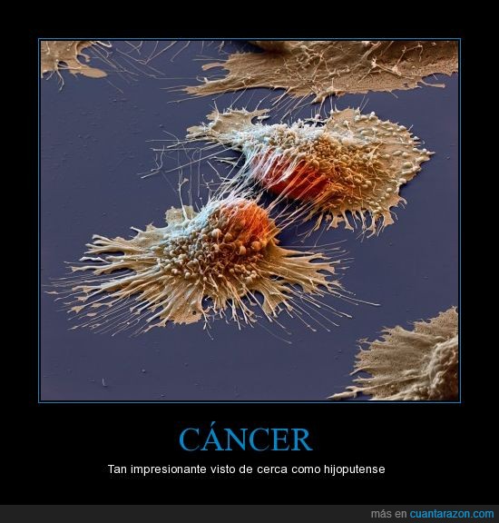 microscopio,cancer,celula