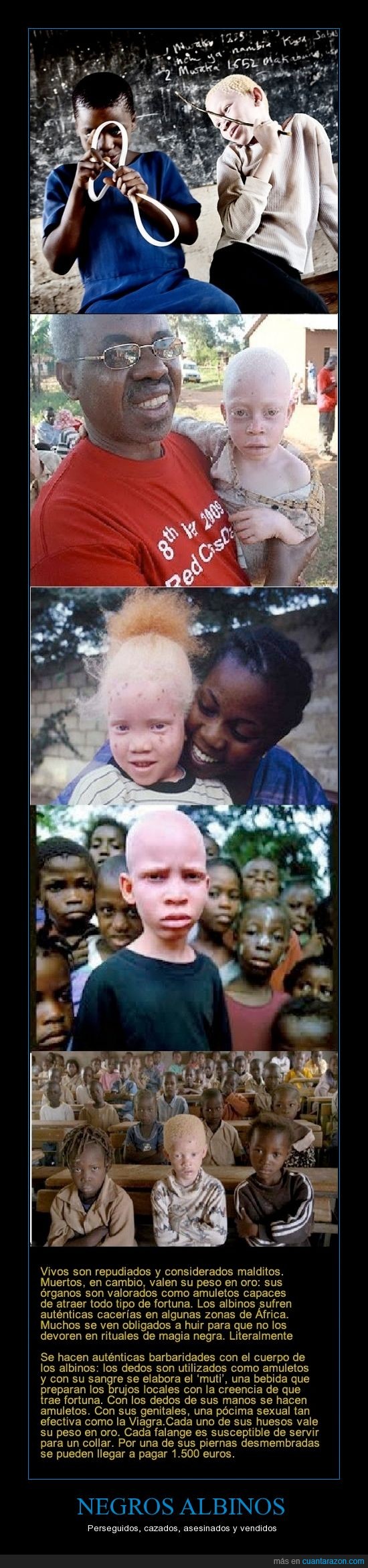 africa,albino,asesino,barbaridad,color,falange,fertilidad,melanina,muti,negro,pocima,pocion,viagra