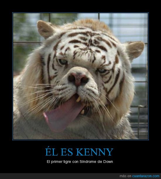 kenny,tigre,sindrome,down