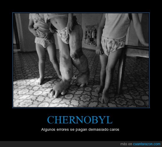 Chernobyl,error,humano,nuclear,pierna