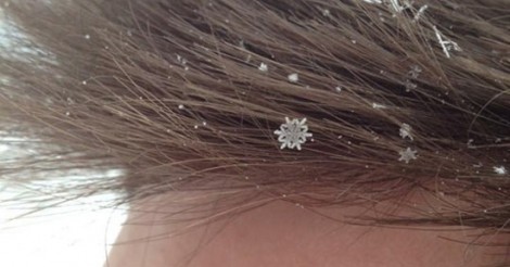 Cuanta Razon Copos De Nieve