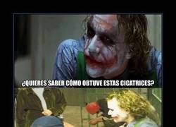 Enlace a Las cicatrices del Joker