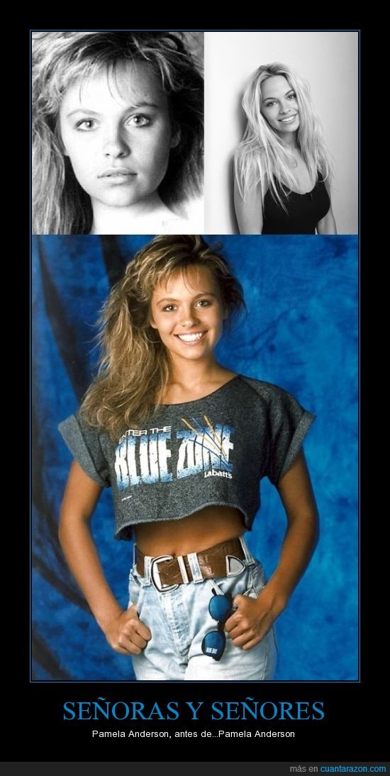 fama,antes y después,Pamela Anderson,cirugías,Playboy,belleza femenina,juventud