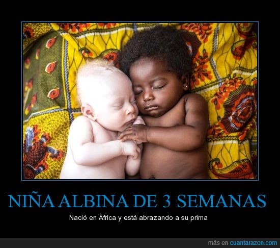 albina,bebe,blanca,color,negra,niña,pequeña