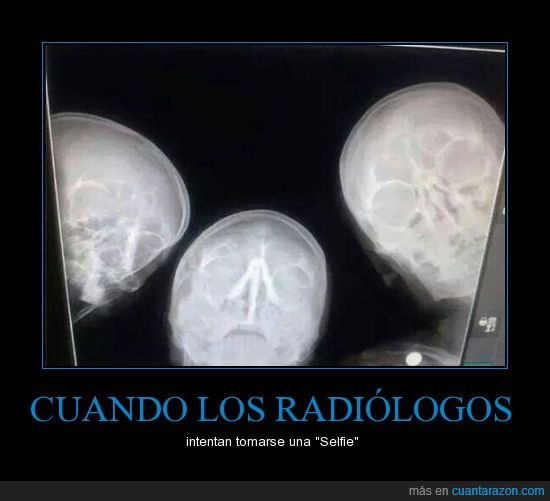radiologos,no me gusta decirle selfie,autofoto,gracioso,radiografía