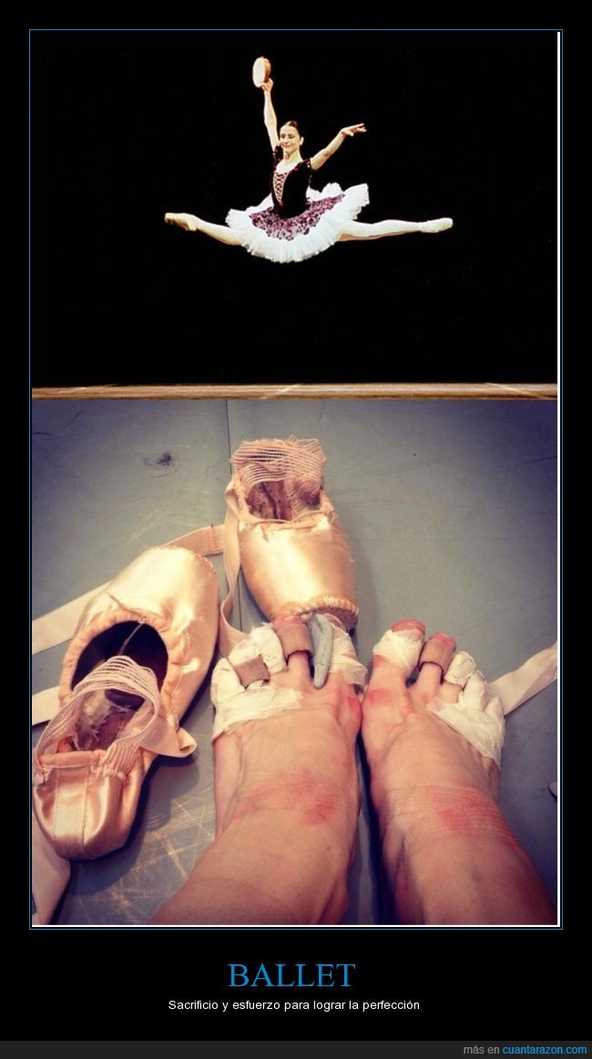 dolor,pies,ballet,bailarina,heridas,baile,arte