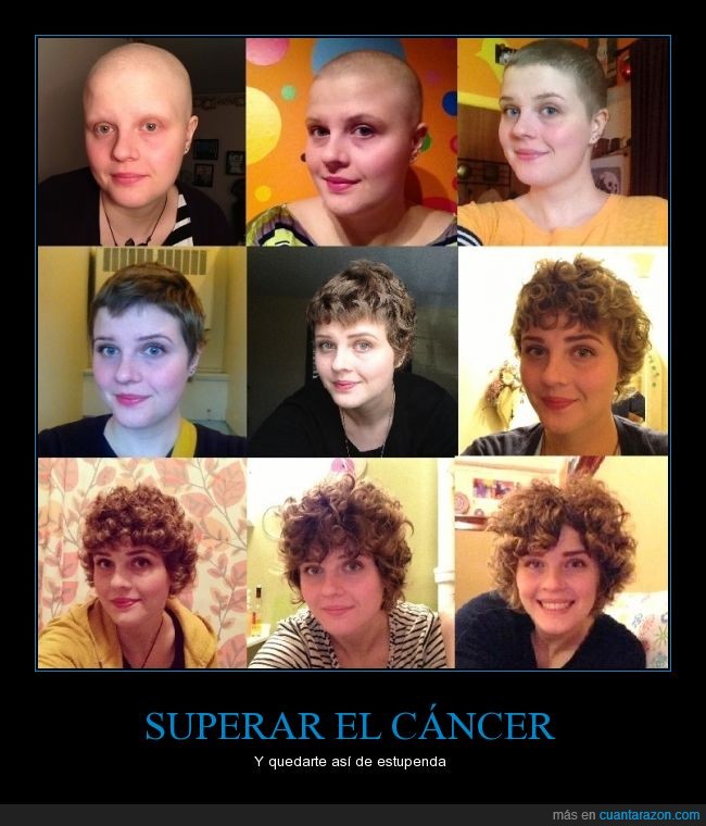 cabeza,afeitada,sonrisa,rubia,rizos,rizado,pelo,superar,cancer,chica