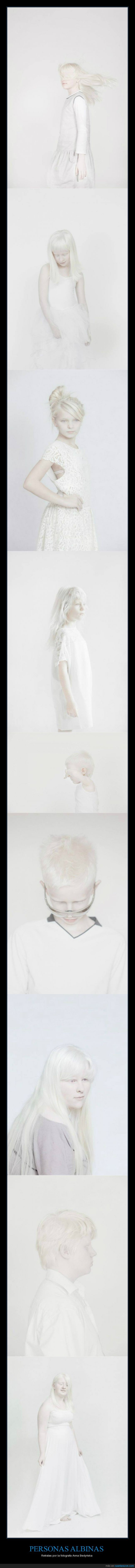 albino,Anna Bedynska,blanco,brillo,fotografa,me siento negra,papel