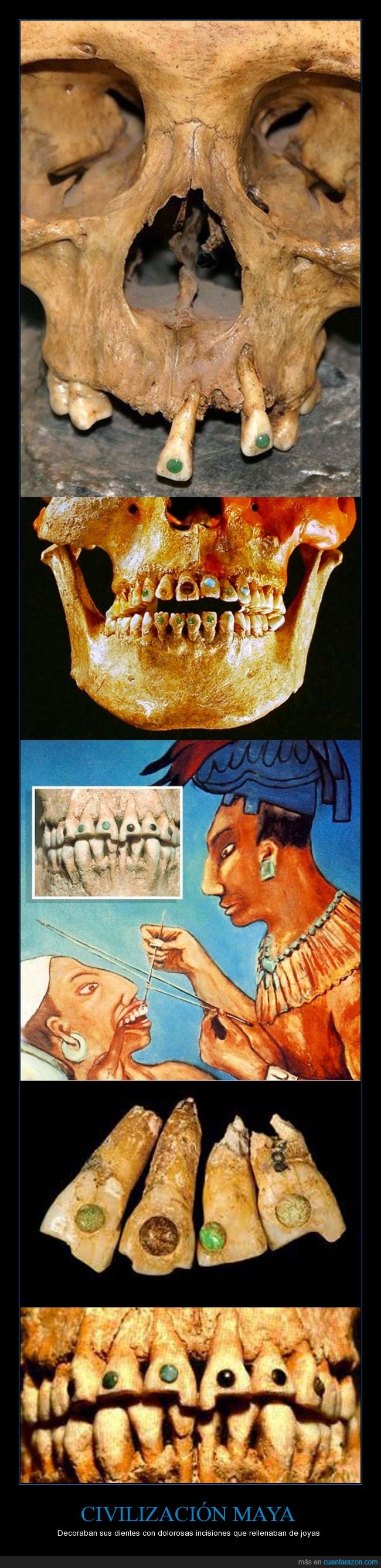 diente,dentista,joya,piedra,preciosa,dientes,maya,mayas,civilizacion,precolombino
