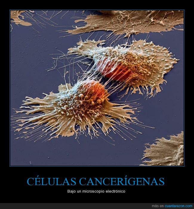 células,cancer,cancerígenas,microscopio