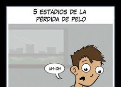 Enlace a PERDER EL PELO