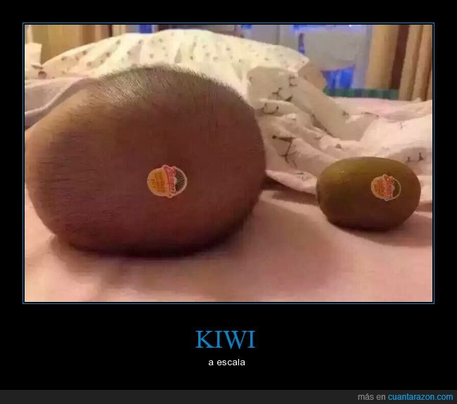 Bebé,kiwi,parecidos,fruta,cabeza,mollera,etiqueta,pelo