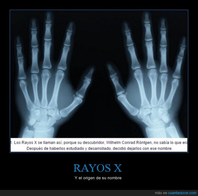 ¡Cuánta razón! / RAYOS X