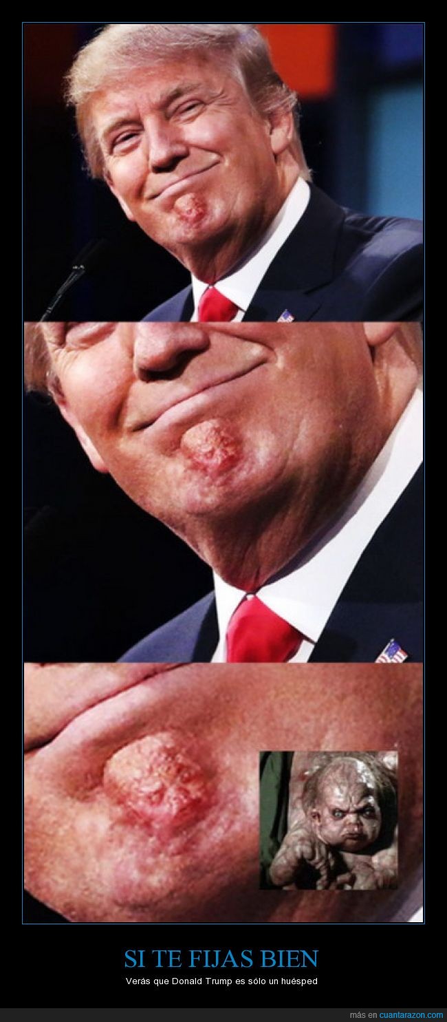 Donald Trump,barbilla,Desafío total