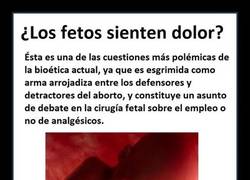 Enlace a ¿Sienten los fetos dolor?