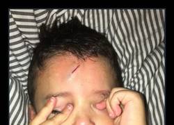 Enlace a Cuando tu hijo se hace una herida, tú vas y se la haces un 200% más mágica