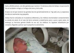 Enlace a Una gemela prematura sobrevivió gracias a que la enfermera se saltó las normas