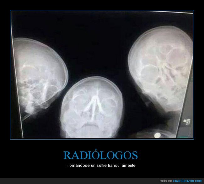 radiografía,selfie