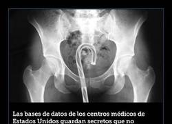 Enlace a Algunos de los objetos que los estadounidenses se han introducido por sus orificios en 2016