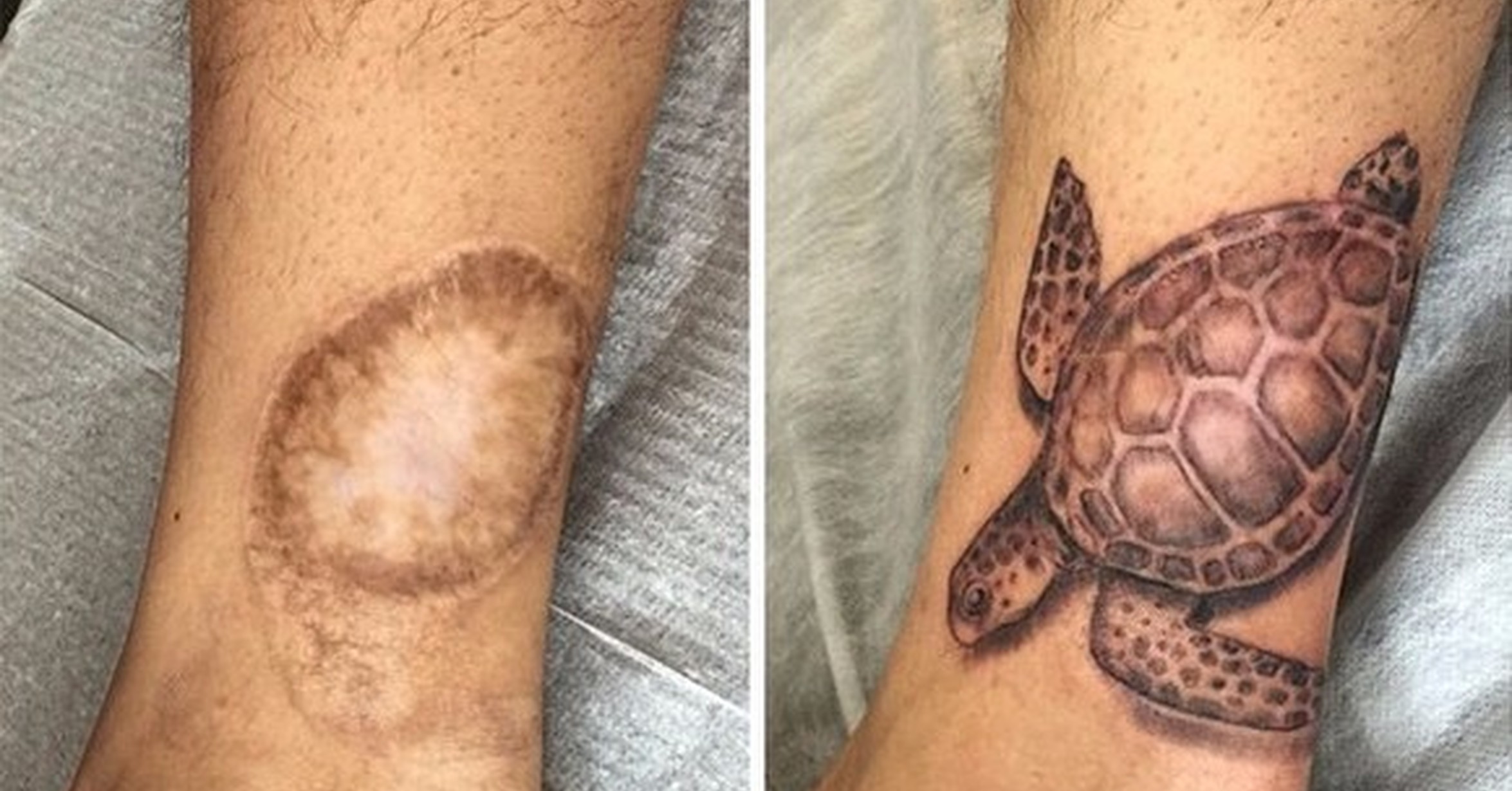 ¡Cuánta razón! / 15 tatuajes que convierten las cicatrices en ...