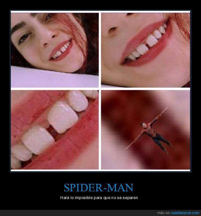 diastema,dientes,fuerza,Spiderman